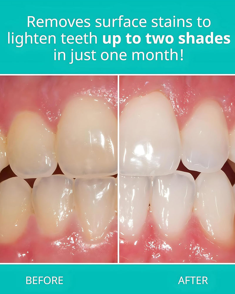 Opalescence Whitening Toothpaste, Mint Flavor, 100ml