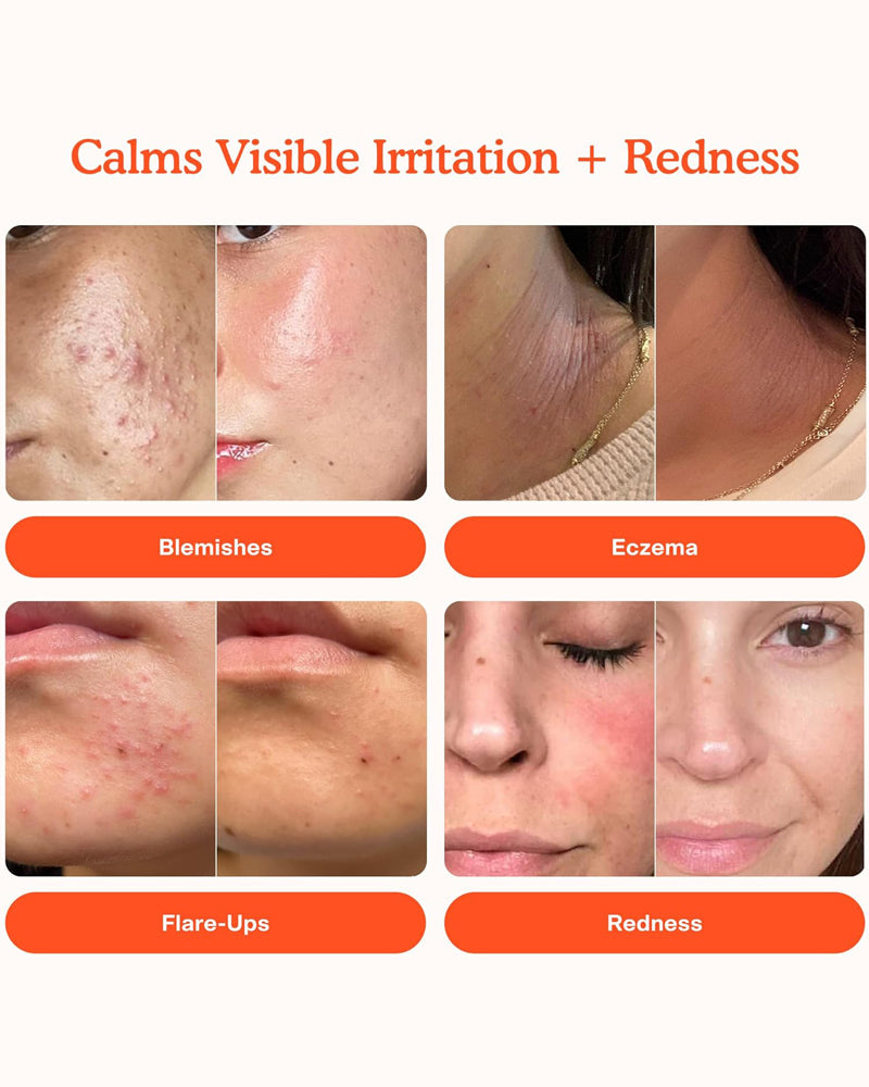 Tower 28 SOS Daily Rescue Facial Spray, 1 FL Oz