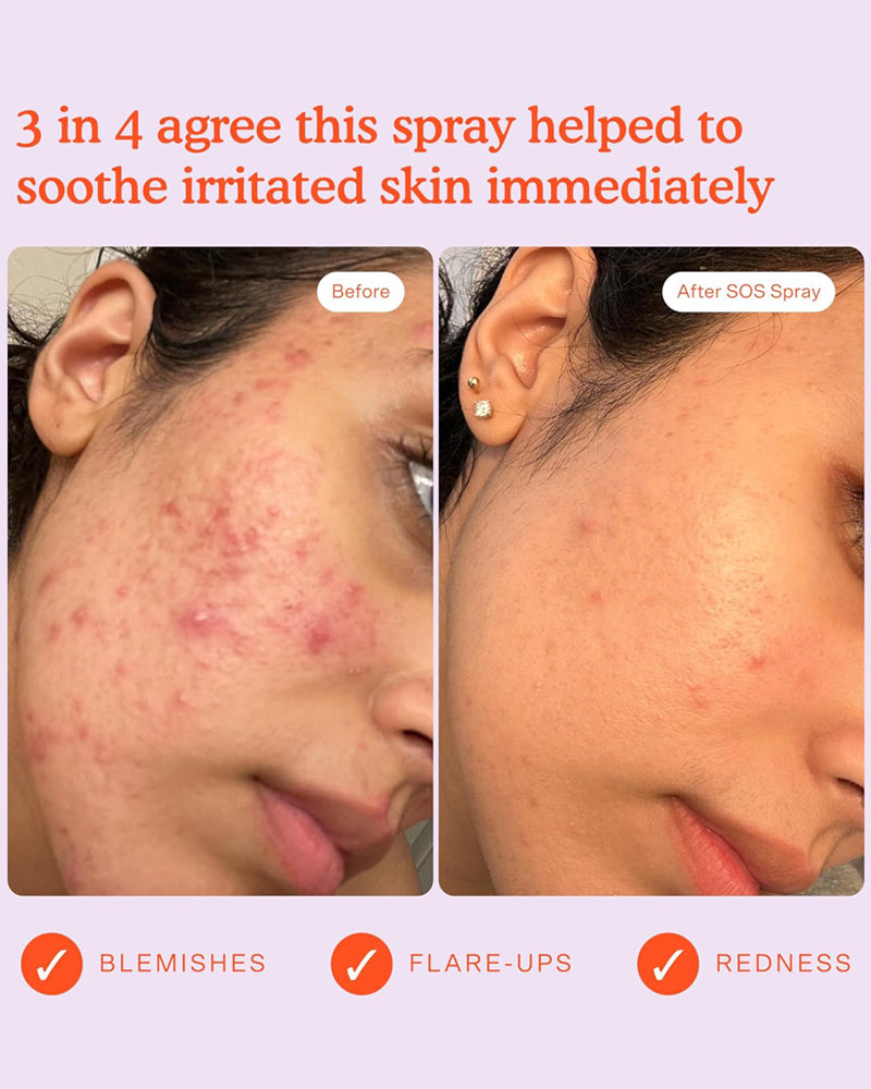 Tower 28 SOS Daily Rescue Facial Spray, 1 FL Oz