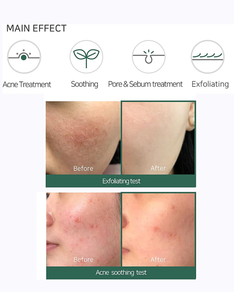 SOME BY MI AHA.BHA.PHA 30 Days Miracle Foam