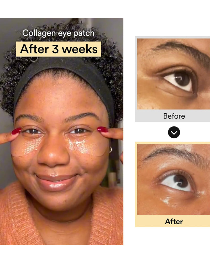 ABIB Collagen Eye Patch