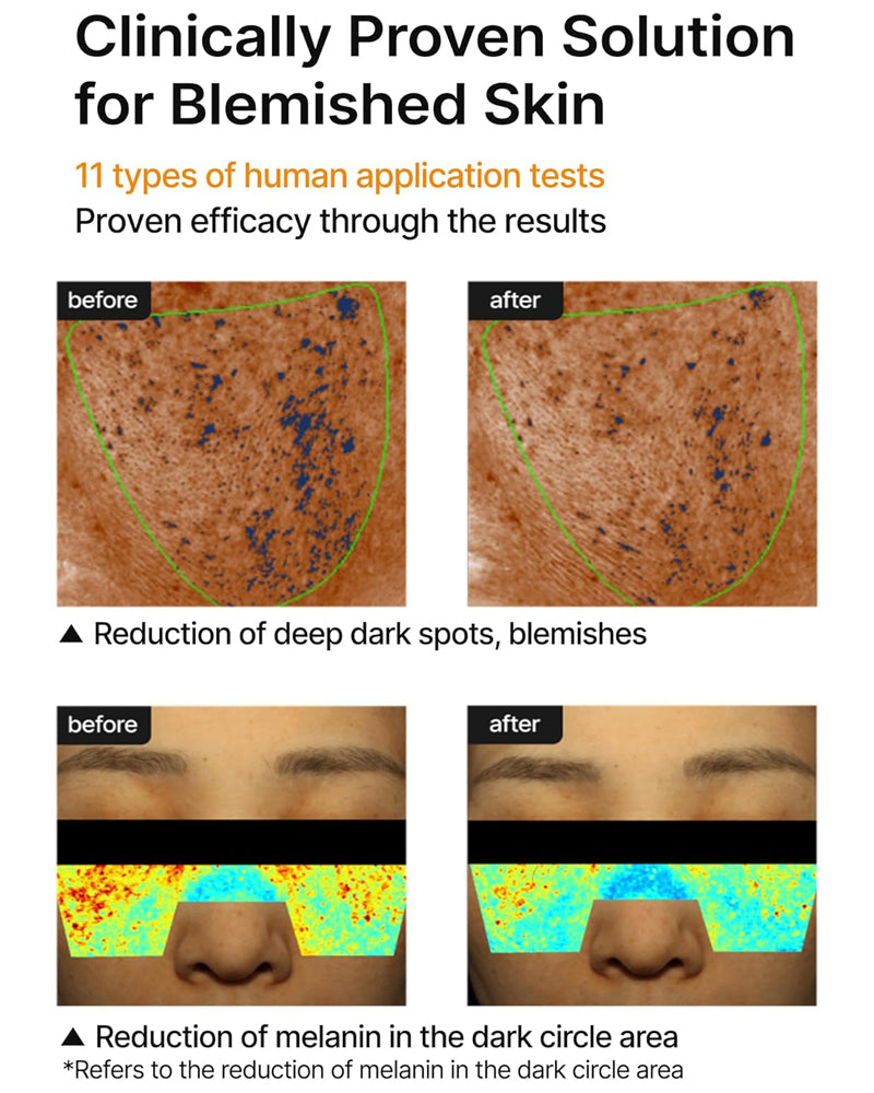 celimax Pore + Dark Spot Brightening Cream, 35ml (For wholesale rate inquiry, please contact +971 55 7708296) (Copy)