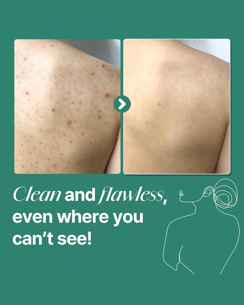 SOME BY MI AHA.BHA.PHA Miracle Acne Clear Body Cleanser