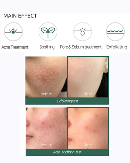 SOME BY MI AHA.BHA.PHA 30 Days Miracle Foam