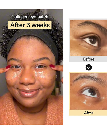 ABIB Collagen Eye Patch
